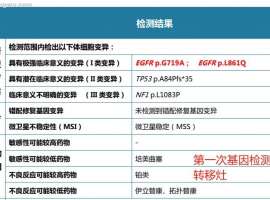 G719A+L861Q双罕见突变治疗24个月，下一步怎么办？