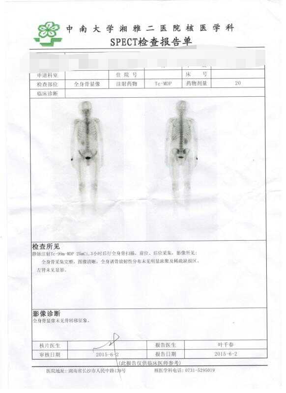 骨扫描